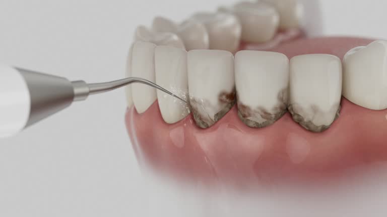 Reliable Root Canal Treatment contractor in Calhoun County County, AR by Dentist Open Now